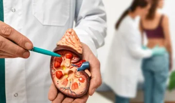 From what do the kidney stones create?
