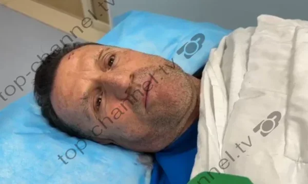 Bolje kot na bencinski črpalki, odvetnik Ilirja Meta: Eden je bil žaljiv, drugi me je udaril v tilnik z rezalnim strojem.