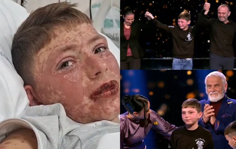 A történet, amely megérintette az albánokat, Sadiku visszatért gyógyult a “show az albán”