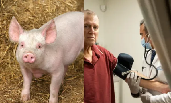 Po 271 dnech je americká ledvina odstraněna.
