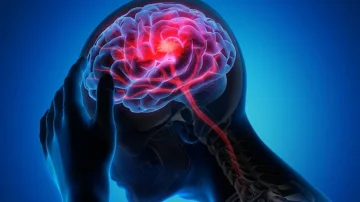 The connection between blood type and brain attack to the elderly