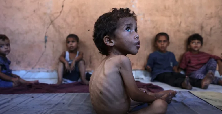 Amnesty anklager Israel for bevidst at forårsage sult i Gaza