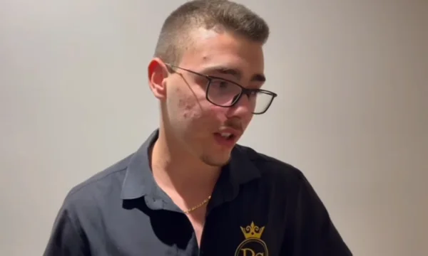 Der Kellner, der von der Polizei und einem anderen in Vlora angegriffen wurde: Für eine Flasche Wasser schlug er mich, wandte ich mich gerade 18 (Video)