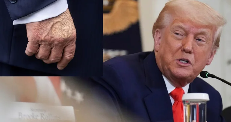 Casa Bianca conferma: Trump ha problemi con il flusso di sangue sui suoi piedi