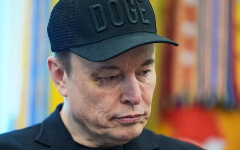 Elon Musk appare con un occhio nero durante la conferenza di addio con Donald Trump