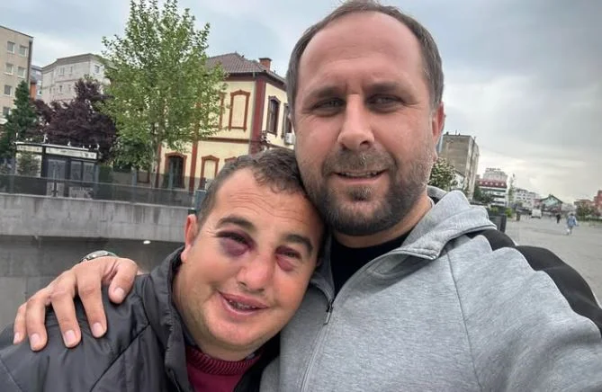 Un handicapé attaqué à Ferizaj