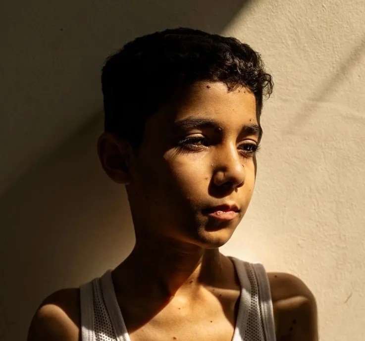 The Gaza boy's portrait is declared “World Press's Best Photo 20250)