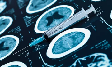 Recent research on Alzheimer's may help identify better drugs