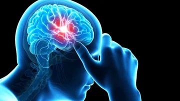 What you should know about pain on one side of your head
