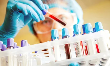 If you have this blood group, you're likely to stay young for many years