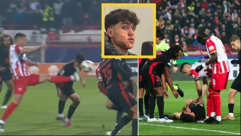 Cubars ended with 10 stitches in his face because of the terrible injury in the Champions League