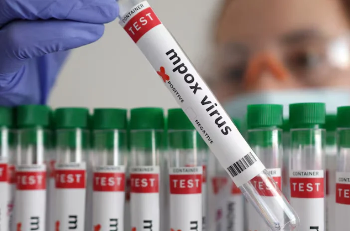 Germany records the first case with a new version of monkey oak