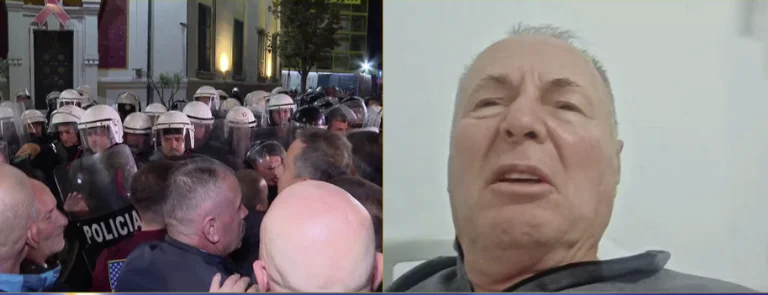 “J'ai une brûlure au troisième degré”/ Parle le citoyen blessé par Molotov en signe de protestation
