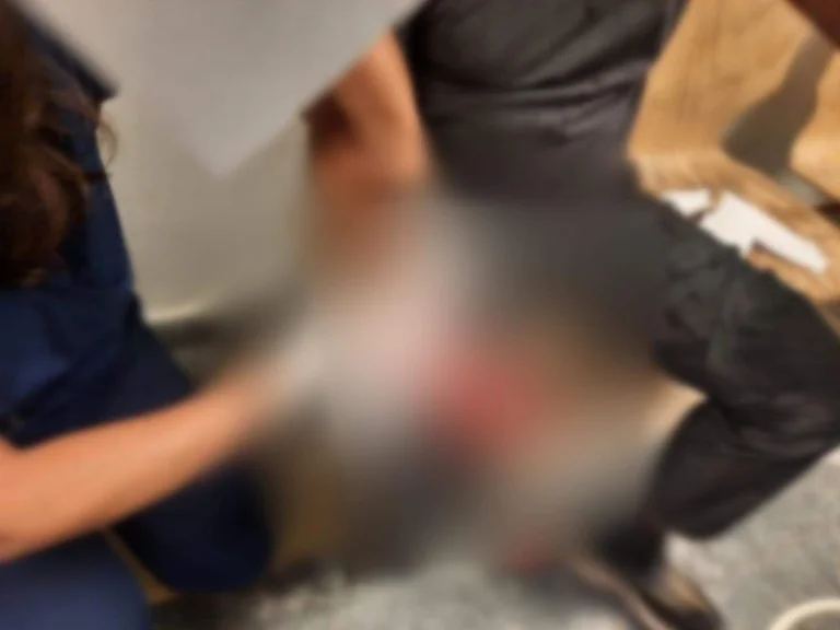 Heavy view: Wild dogs attack two people in the KKUK courtyard near Orthopedic Clinic