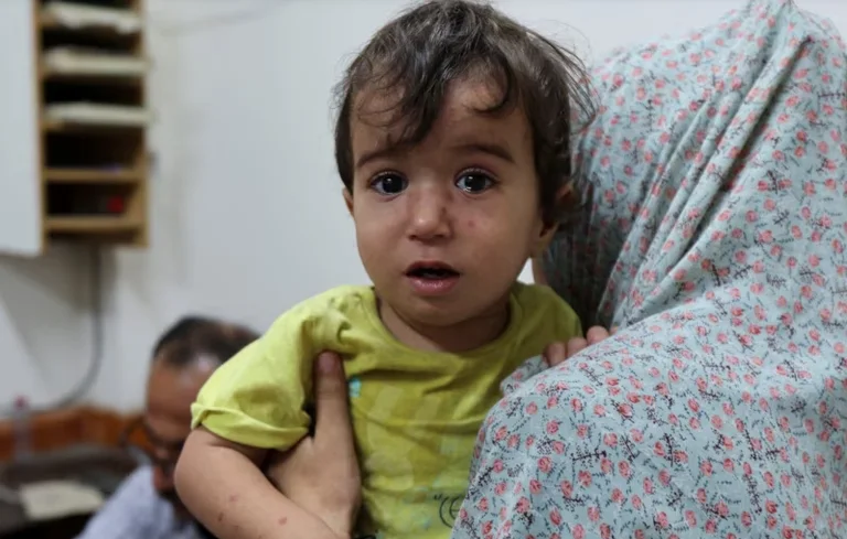 O B S: Agreement for brief pauses in Gaza for polio vaccine