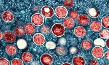 What's a monkey's line? The new virus that emerged in Europe today