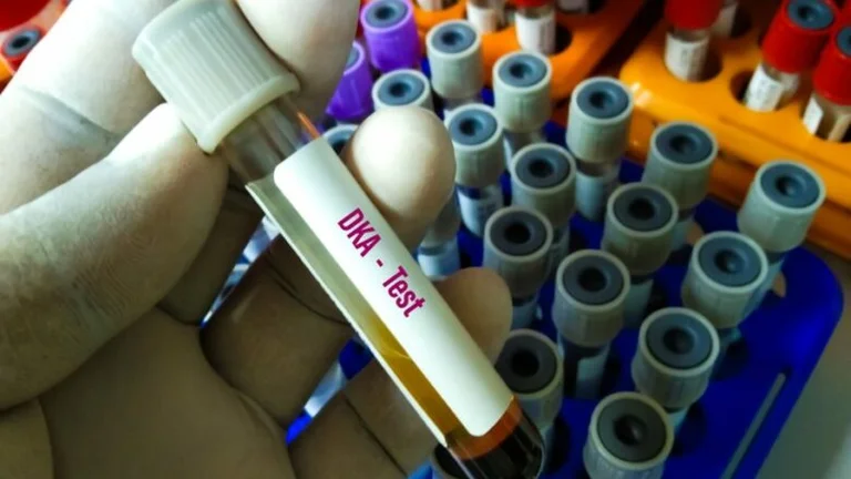 Diabetes Comea: Wann und welche Symptome kann diese Situation bekannt sein
