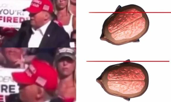 The illustration shows how close Trump was to death: What would have happened if he hadn't turned his head at that moment