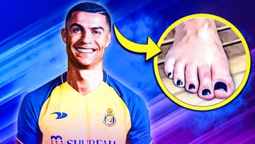 Warum hat Ronaldo immer schwarze Maniküre auf seinen Füßen? Es gibt einen guten Grund