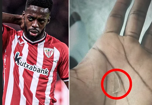 Williams has been playing for the last two years with a two-inch glass piece embedded in his leg.