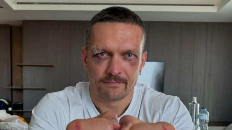 Il re di boxe esce con un video dopo il feroce duello: Mostra le ferite che ha sofferto nelle mani di Tyson Fury
