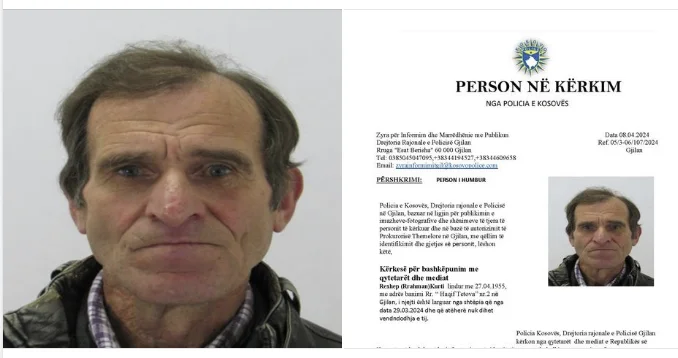 Humb një person në Gjilan, policia publikon fotografin dhe kërkon ndihmë për gjetjen e tij