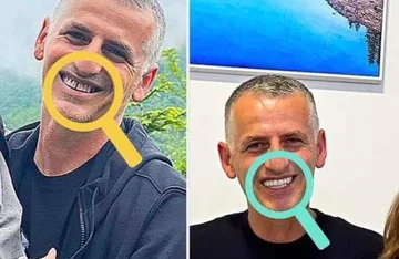 11 Modi per mantenere i tuoi denti sani
