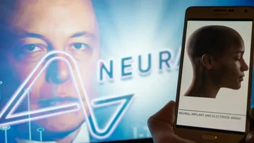 Elon Musk informa que Neuralink colocó con éxito el chip en el cerebro humano