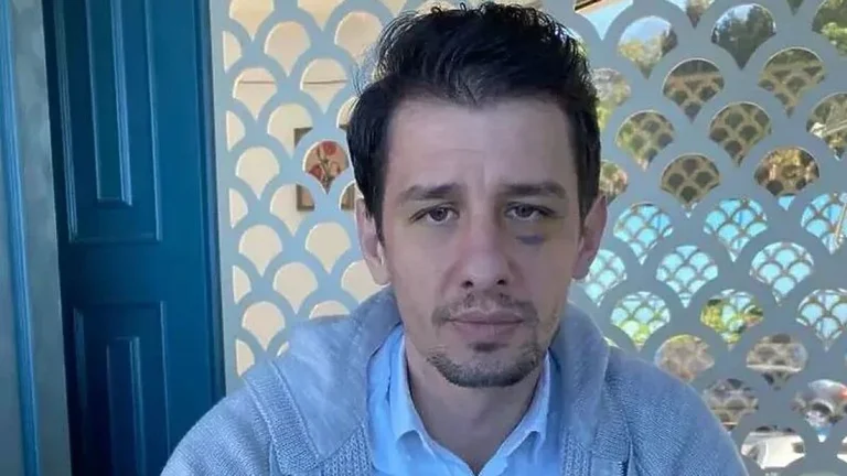 After being released from hospital, Turkish judge discovers for the first time who urged Ankara's president to punch and kick