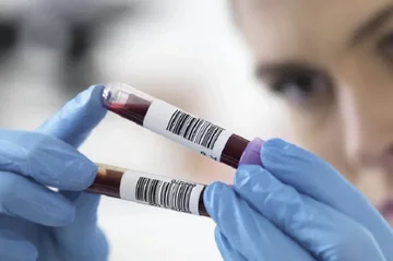 I test del sangue indicano se gli organi invecchiano rapidamente o lentamente