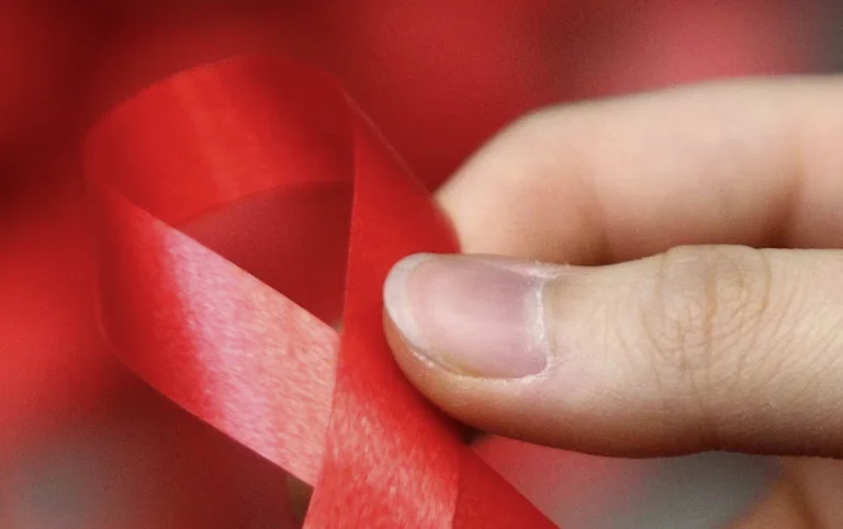13 raste të reja me HIV/AIDS në Kosovë