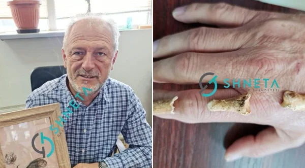 Le foto dei baffi di Adem Jashar e le ossa del dito di Isa Boletin sono pubblicate