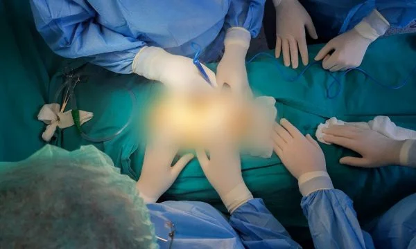 811 casi di rottura del rene a QKUK per 9 mesi