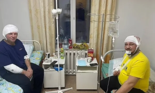 Momenti kur ariu i murrmë sulmon egërsisht dy burra, plagë të rënda në kokë e krahë pas përleshjes (VIDEO)