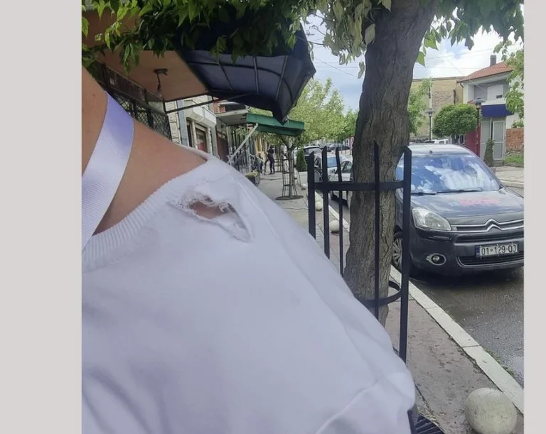 63 raste të sulmeve dhe kërcënimeve kundër gazetarëve dhe medieve janë raportuar për 10 muaj në AGK