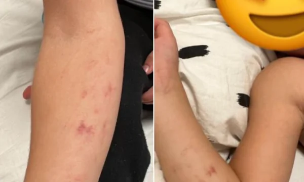 Avokati i familjes së 3-vjeçarit: Në pamje çerdhja dukej më shumë si kamp përqendrimi se sa si institucion edukativ