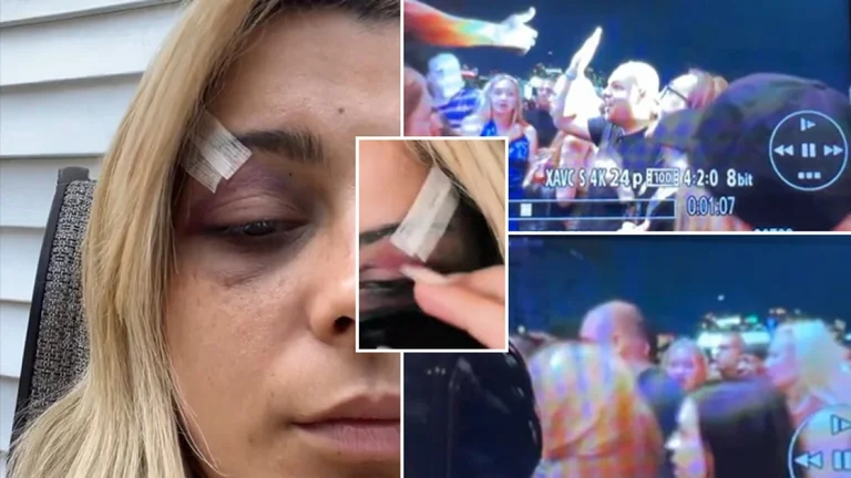 Altre immagini pubblicate dall'arresto dell'aggressore e dalla condizione di Bebe Raj dopo un infortunio al noto concerto