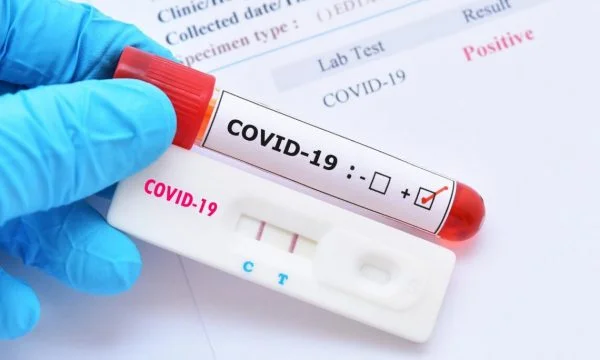 Il y a encore 42 cas actifs avec COVID-19 au Kosovo