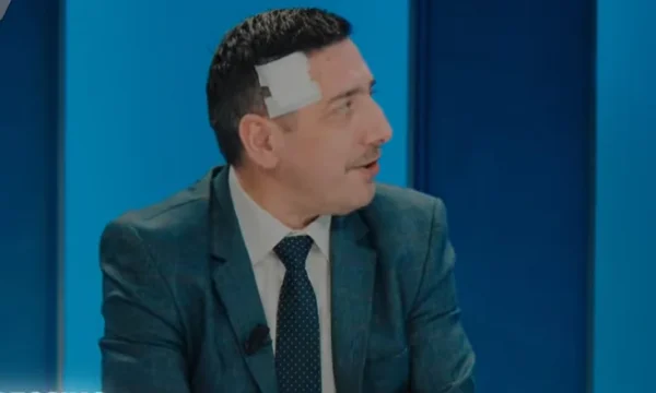<x0]Gruch sobre la cabeza de otras partes del cuerpo fuerex1⁄4], archivo para ataque contra la periodista Syla, Fiscalía describe cómo sucedió todo