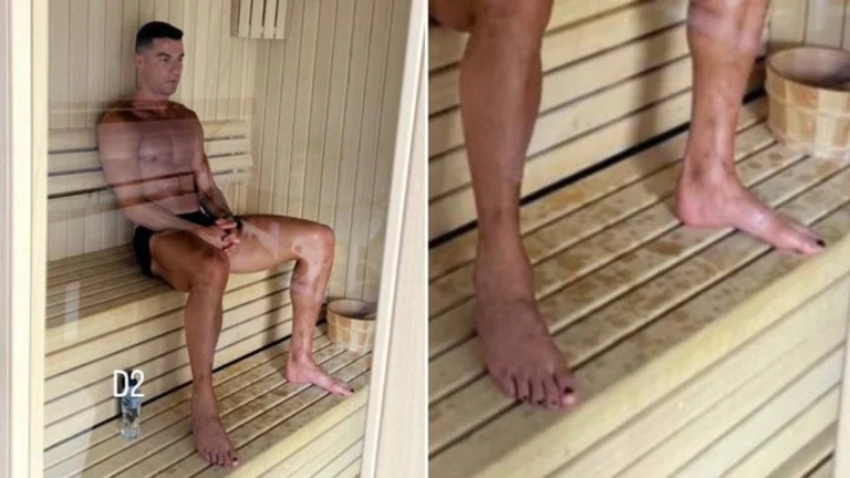 Col descubrió por qué Ronaldo tiñe sus uñas
