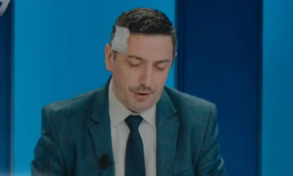 El ojo apunta a momentos después del ataque de anoche