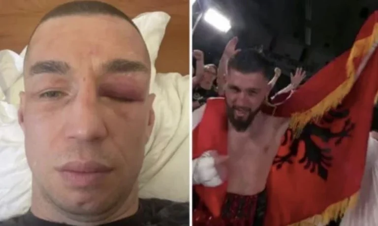 Il pugile serbo battuto da Bernardin Jakaj risponde agli albanesi con un posto provocatorio
