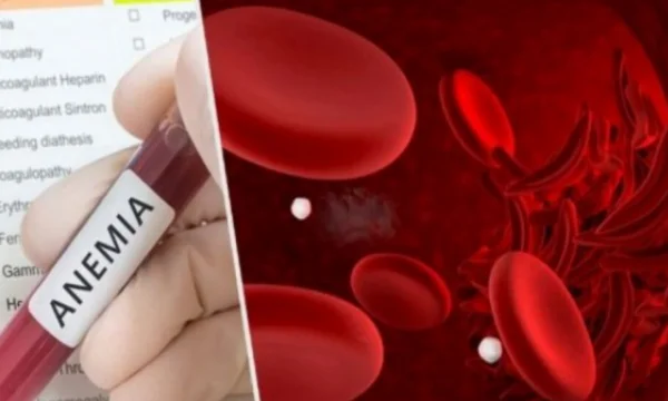 Vuan dall'Anemia? Poi prendere questo cibo e vedere la differenza