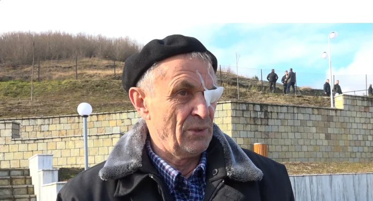 I mbijetuari i masakrës së Reçakut rrëfen tmerrin: I kanë lënë pa sy e pa zemër, ka pas edhe pa kokë