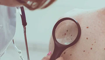 Skin cancer symptoms most people ignore