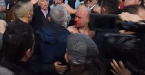 Sali Berisha Attack Identified