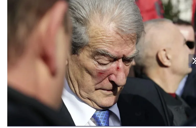 Foreign media reflect the incident in the opposition protest, Politicalo: As the aggressor punched Berisha