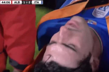 Der Moment, in dem die Natoli von Mailand verletzt wird, kommt aus dem Stretcherspiel in freundlichen Albanien