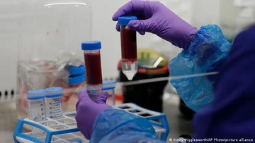 Un nuovo esame del sangue rivela oltre 50 tipi di cancro