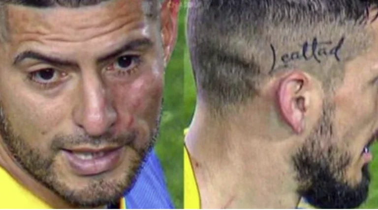Cher tra i giocatori di Boca Juniors sono stati mal battuti tra di loro nel negozio di strip